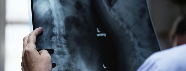 xrays.jpg